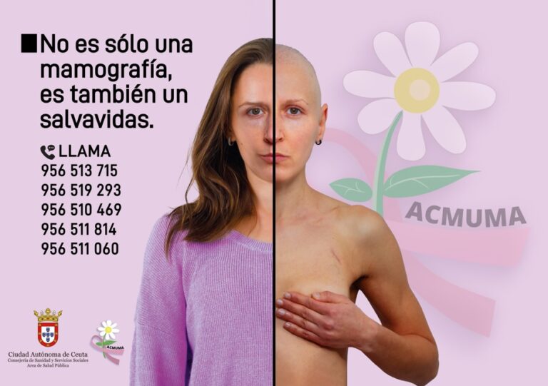 La AD Ceuta FC y ACMUMA se unen en un emotivo gesto con motivo del Día Internacional del Cáncer de Mama